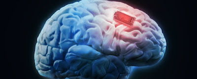 Eidetic Memory vs Hyperthymesia Eidetic Memory vs Hyperthymesia
